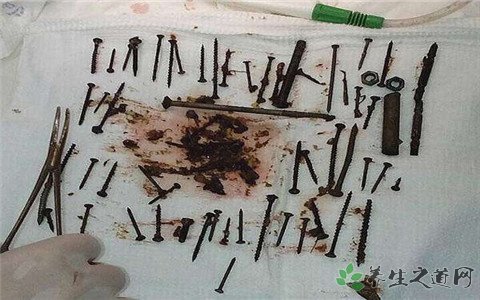 老太吞铁钉补铁 老人贫血吃什么好
