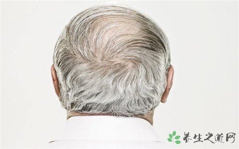80后白发干部 如何对症除白发