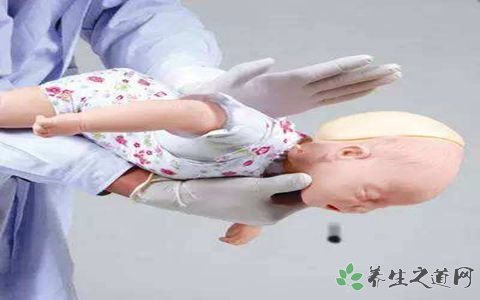 2岁女童奶糖卡喉 小孩异物卡喉怎么急救