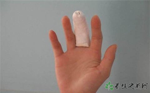 手指被可乐炸骨折 骨折后如何护理