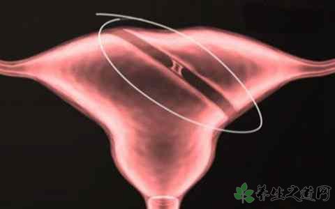 医生擅切子宫 子宫的功能有哪些